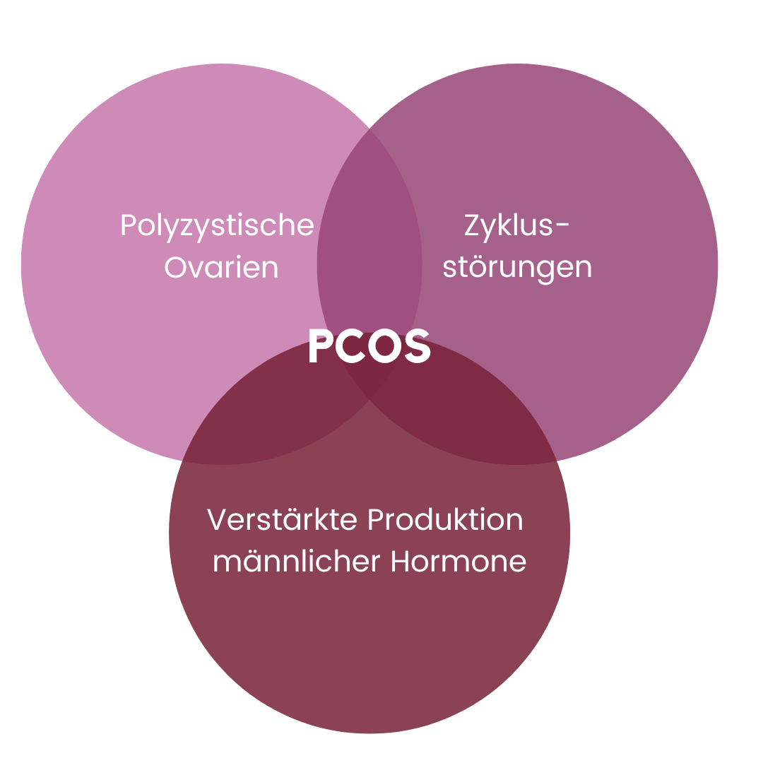 Infografik: Diagnostik bei PCOS / Rotterdam Kriterien